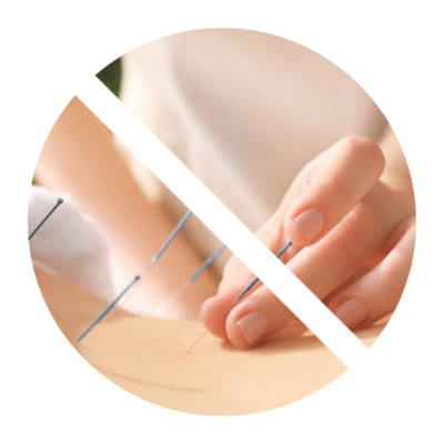 no-needle-acupuncture